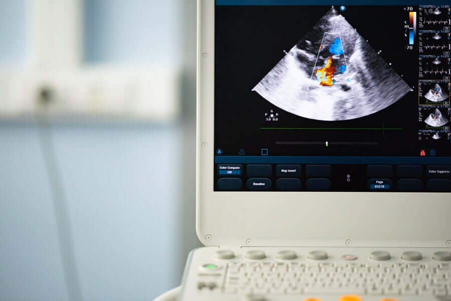 Válvula aórtica bicúspide: diagnóstico e tratamento