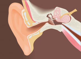 Cirurgia para a exostose: quando operar?