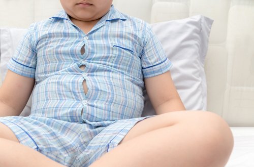 8 doenças relacionadas à obesidade infantil