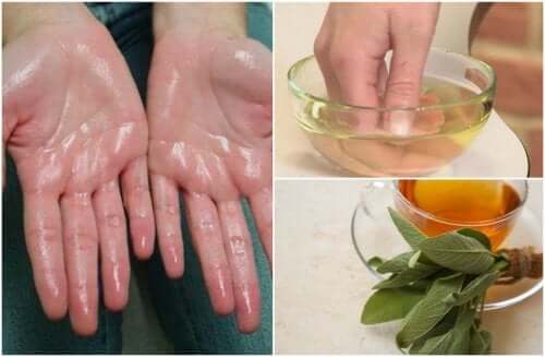 Disidrose palmar e plantar