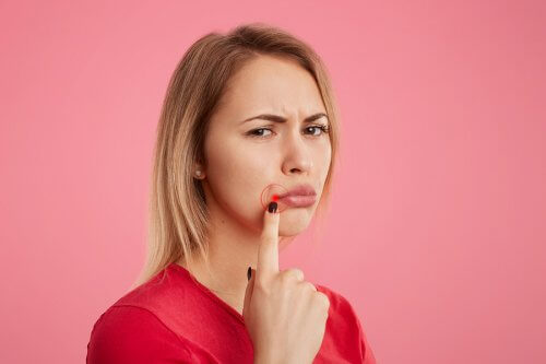 5 remédios para eliminar o herpes labial