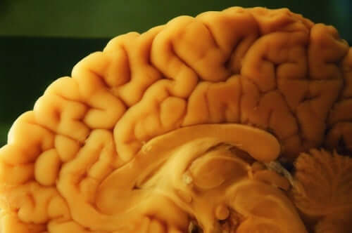Remoção do cérebro para análise