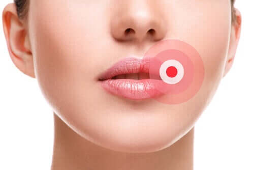 Como eliminar o herpes labial