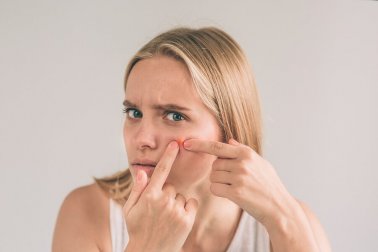 5 ingredientes naturais para combater os furúnculos