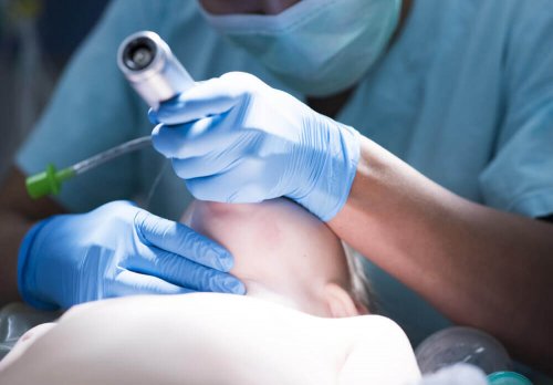 Médico fazendo intubação