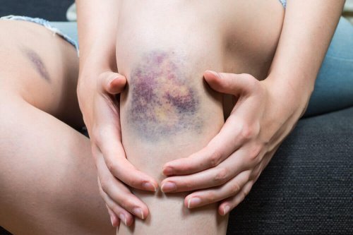 Quais são as causas da tromboflebite superficial?