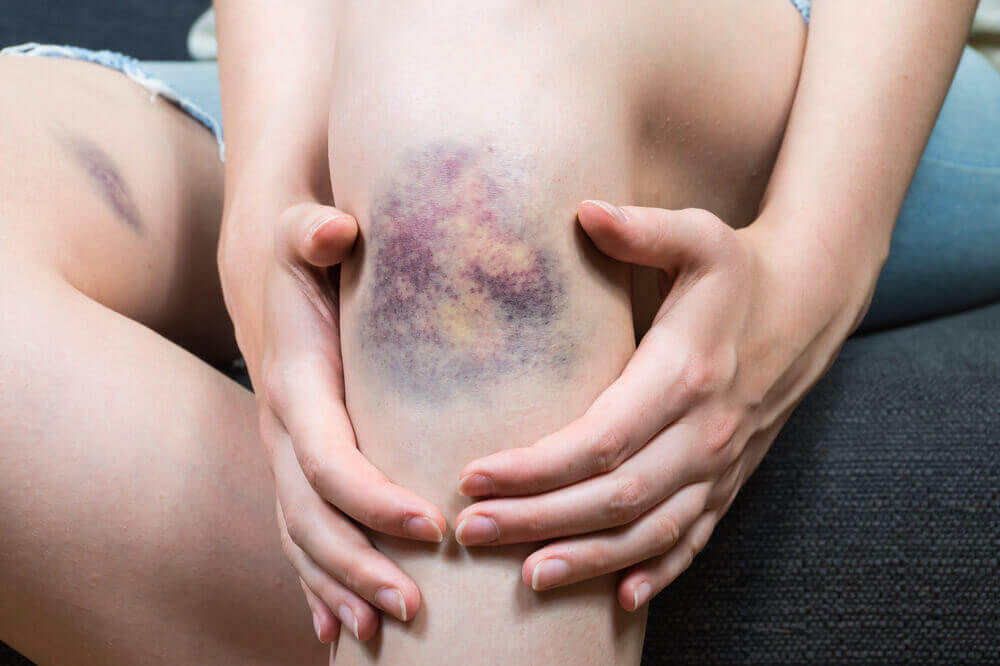 Quais são as causas da tromboflebite superficial?
