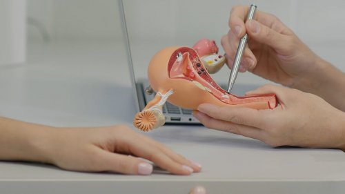Sexo após uma histerectomia