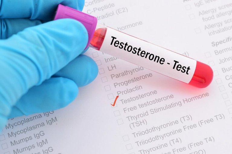O que é a síndrome de deficiência de testosterona?