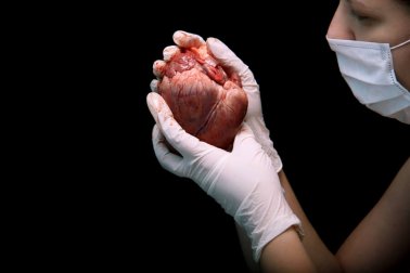 Transplante de coração: como é o processo?