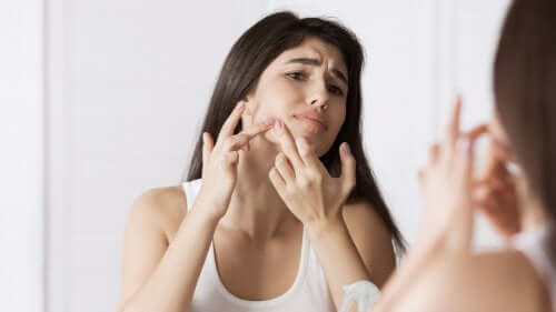Tratamentos naturais para a acne