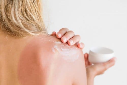 Hidratante para queimadura solar