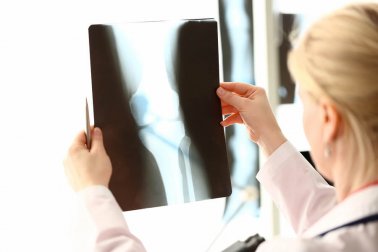 Alimentos com cálcio e vitamina D para proteger a saúde óssea