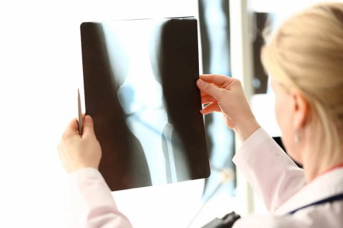 Alimentos com cálcio e vitamina D para proteger a saúde óssea