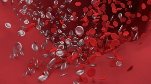 Embolia cerebral: o que é e como nos afeta?