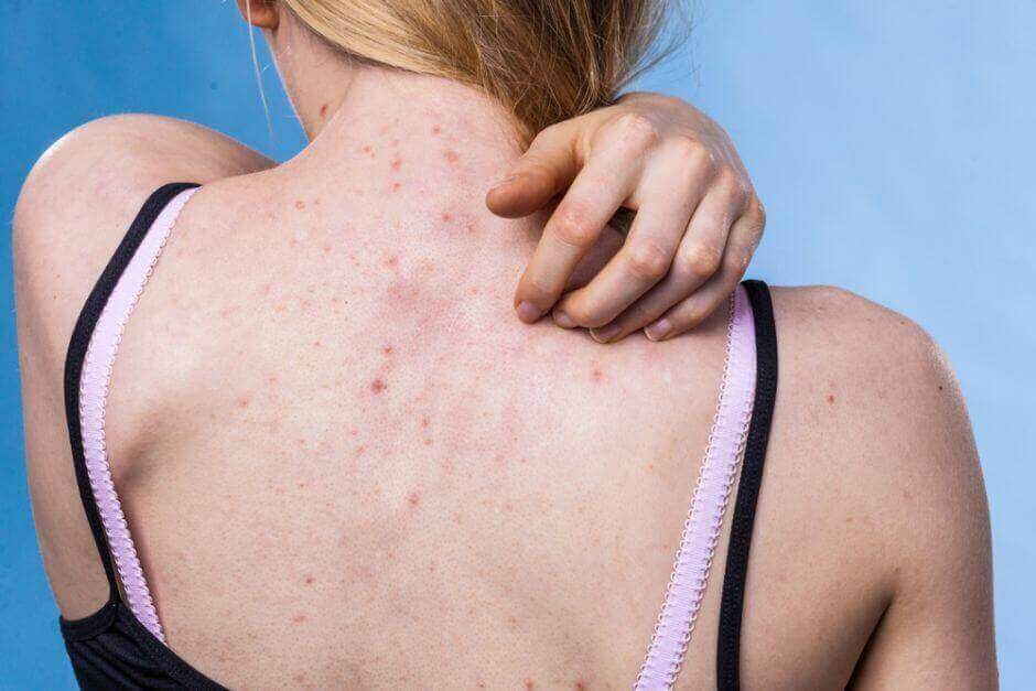 Conselhos para prevenir doenças cutâneas