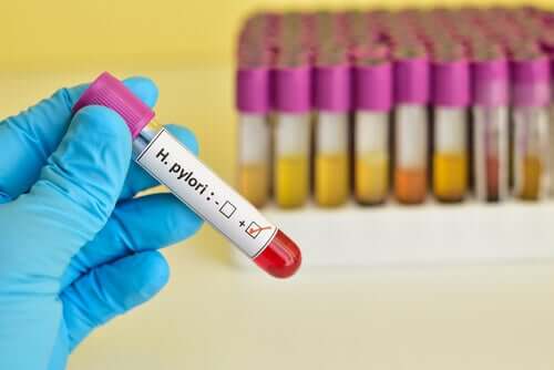 Teste de H. pylori