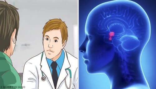 Tumores cerebrais