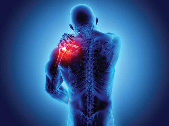 Espondiloartropatias: sintomas e diagnóstico