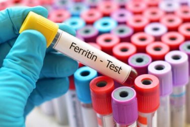 Como baixar a ferritina alta?