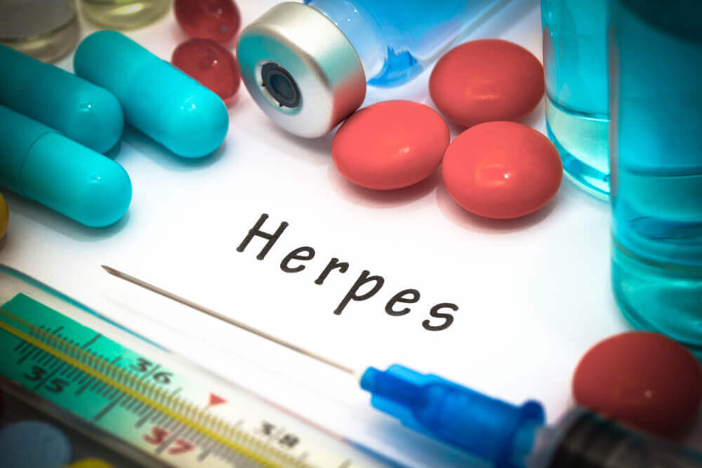 Herpes genital 