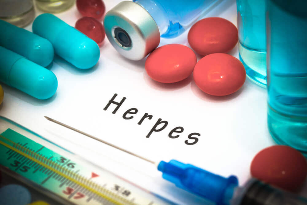 Herpes genital