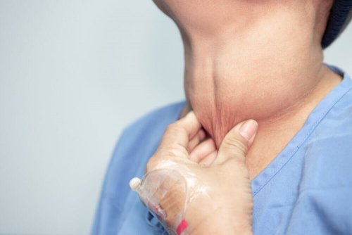 Tumor na tireoide