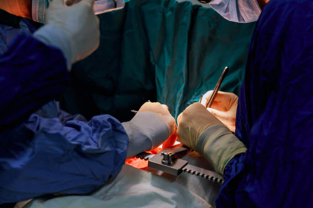 Cirurgia para remover tumor