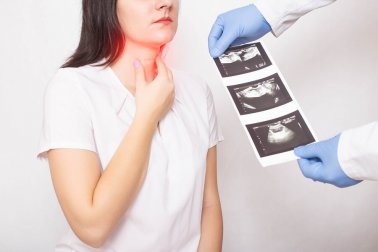 Câncer de tireoide: tudo que você precisa saber