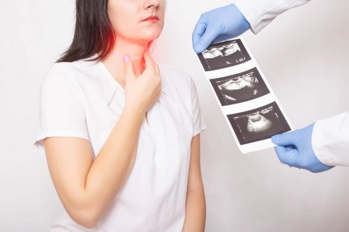 Câncer de tireoide: tudo que você precisa saber