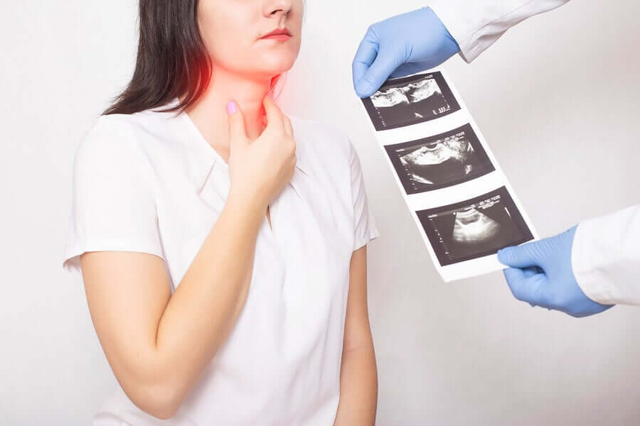 Câncer de tireoide: tudo que você precisa saber