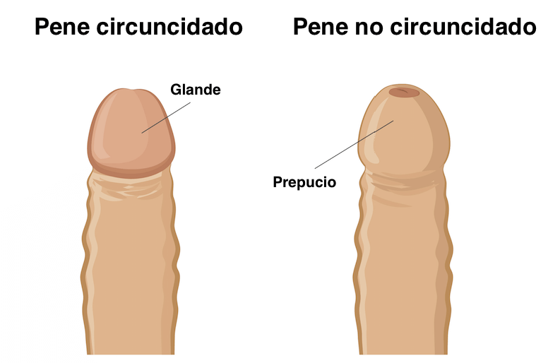 Circuncisão