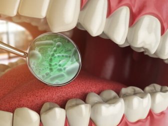 Quais são as bactérias da boca?