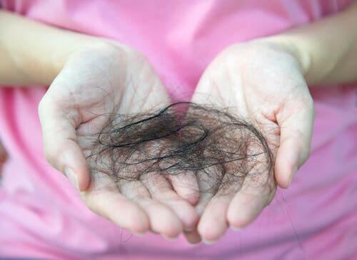 O que você sabe sobre a alopecia pós-parto?