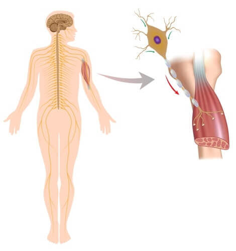 Tipos de doenças neuromusculares
