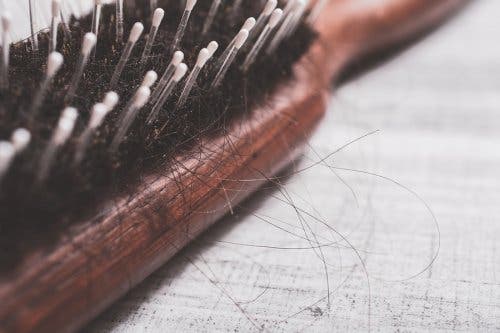 Alopecia pós-parto