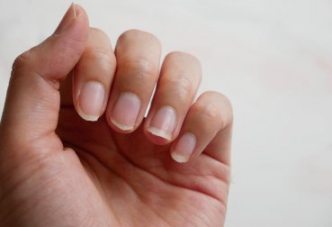 Como endurecer as unhas naturalmente? 5 dicas