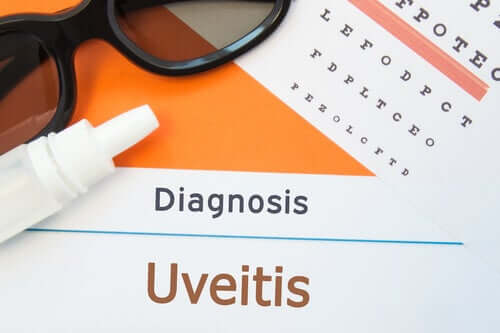 O que é a uveíte e quais são os seus sintomas?
