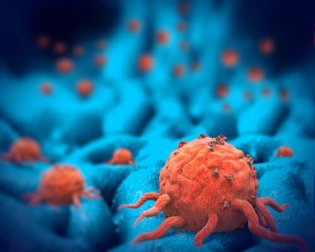 Tumor maligno e benigno: quais são as diferenças?