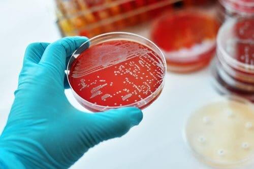 Exame para identificar bactérias