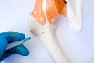 Doação de medula óssea: tudo que você precisa saber