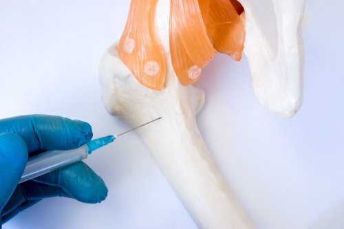 Doação de medula óssea: tudo que você precisa saber