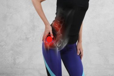 Impacto femoroacetabular: tudo que você precisa saber
