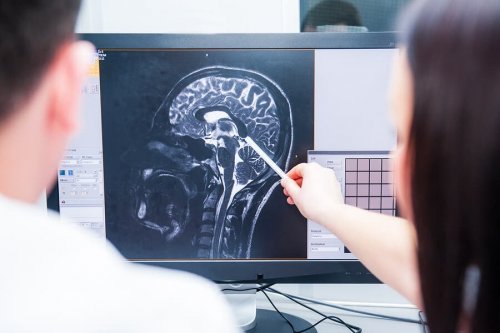 O que é o sistema neuroendócrino?