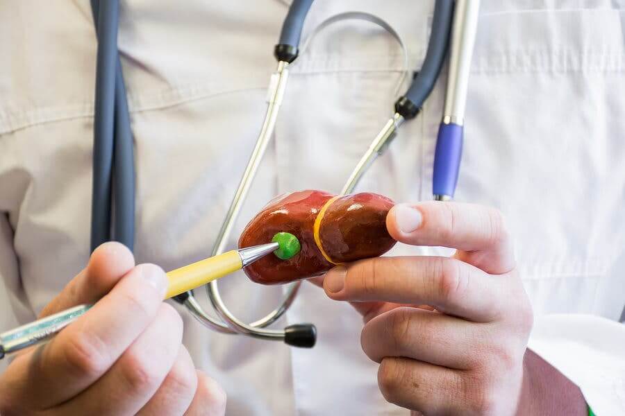 Nutrição e litíase biliar: o que devemos considerar?