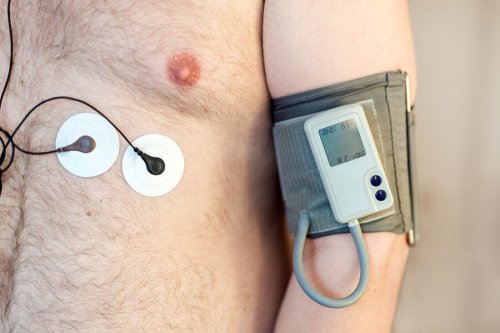 O que é o holter? Para que serve?