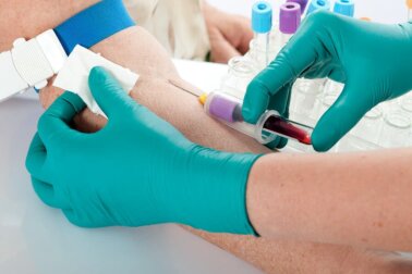 Sintomas e causas de hipercalemia