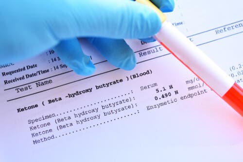 Exames de laboratório