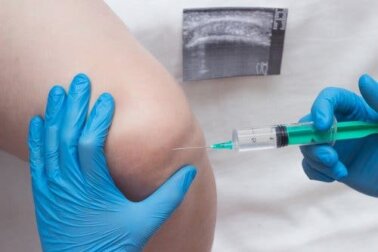 Infiltração: o que é e quando fazer este procedimento?