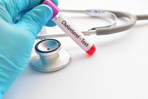 Qual é o nível adequado de colesterol?